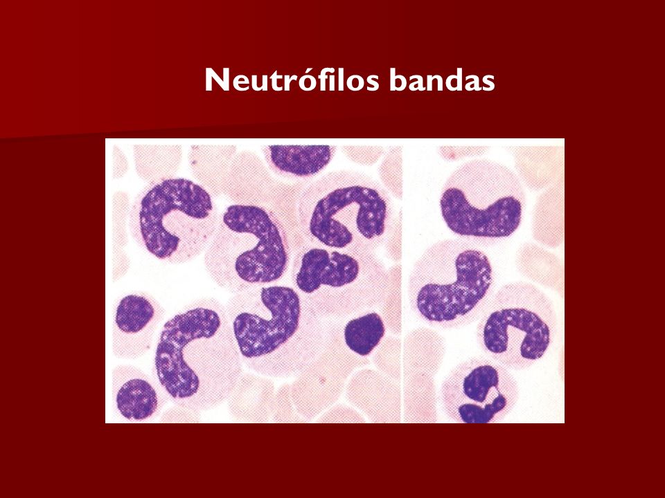 que es neutrofilos totales